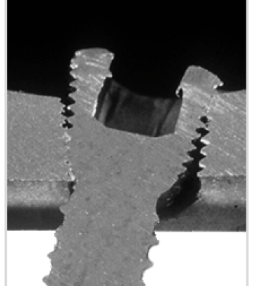 拆钉器怎么使用骨科速读 ｜ 内固定物取出手术相关知识点（下）_https://www.jmylbn.com_新闻资讯_第4张