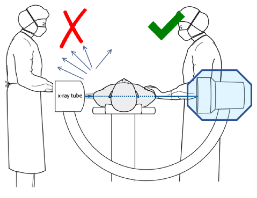 C臂怎么看骨科速读 ｜ 术中使用C臂时，人站在哪里辐射最小？_https://www.jmylbn.com_新闻资讯_第7张