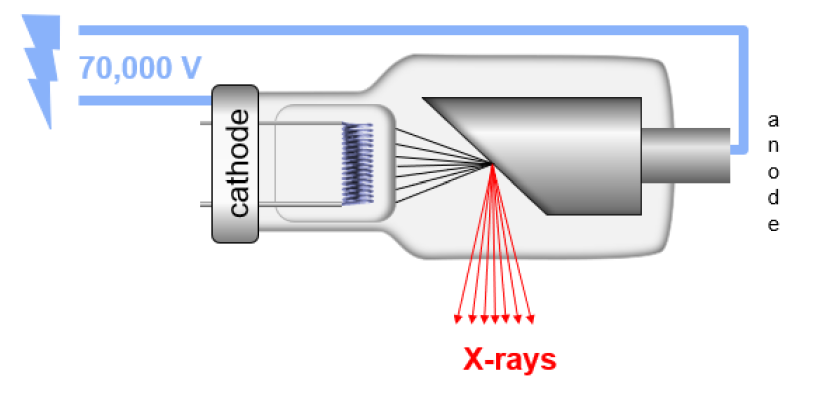 C臂怎么看骨科速读 ｜ 术中使用C臂时，人站在哪里辐射最小？_https://www.jmylbn.com_新闻资讯_第3张