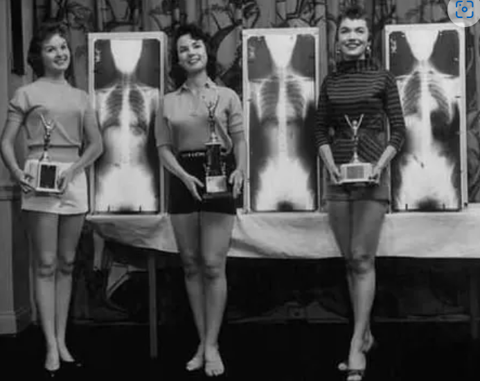 C臂怎么看骨科速读 ｜ 术中使用C臂时，人站在哪里辐射最小？_https://www.jmylbn.com_新闻资讯_第2张