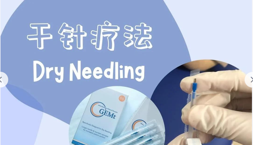 美国干针法没有岐黄之医理(图1)