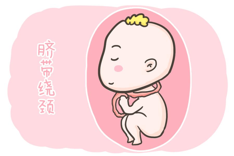 胎儿心电图是什么意思【科普文章】胎儿心电图的科普小知识_https://www.jmylbn.com_新闻资讯_第4张