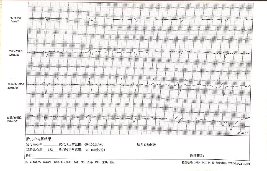 胎儿心电图是什么意思【科普文章】胎儿心电图的科普小知识_https://www.jmylbn.com_新闻资讯_第2张