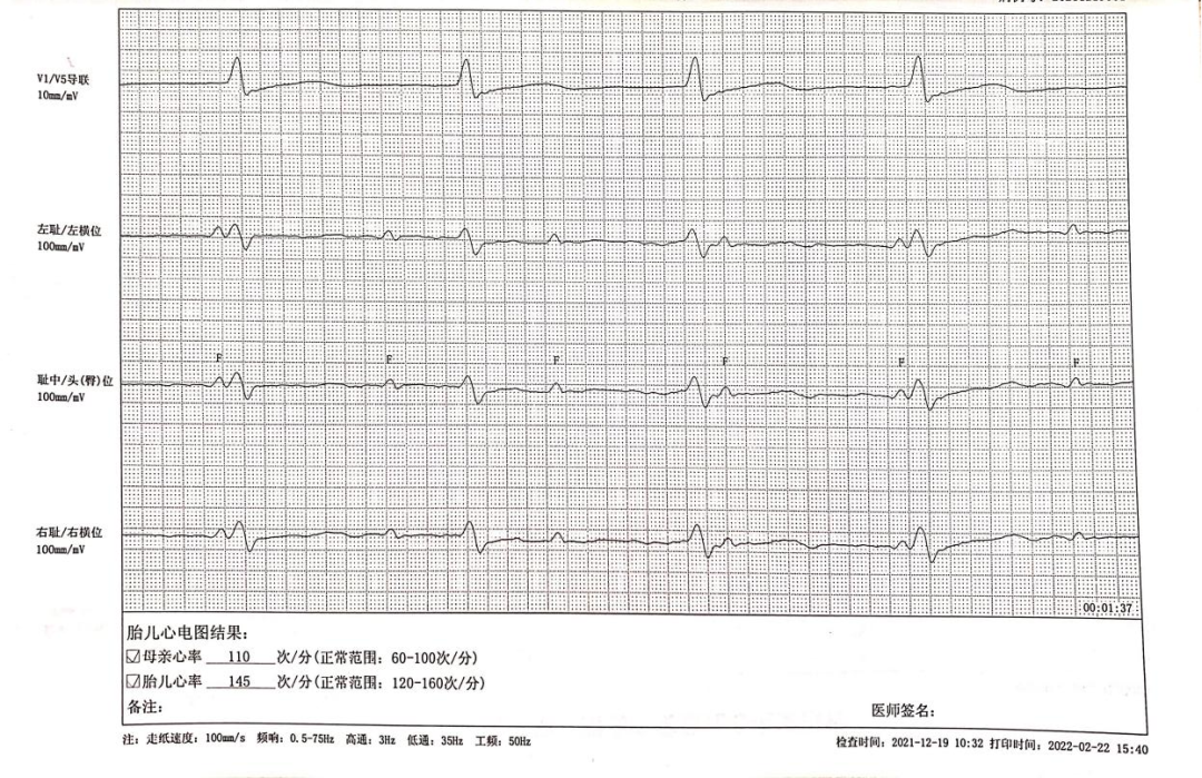 胎儿心电图是什么意思【科普文章】胎儿心电图的科普小知识_https://www.jmylbn.com_新闻资讯_第1张