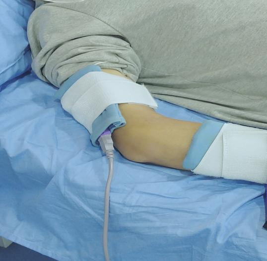 中频为什么可以消炎镇痛、消炎、锻炼？中频电疗法了解一下_https://www.jmylbn.com_新闻资讯_第6张