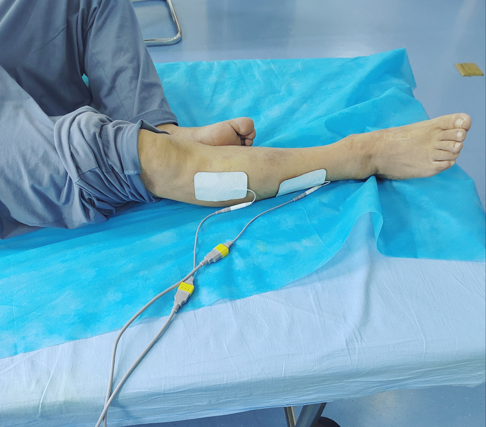 中频为什么可以消炎镇痛、消炎、锻炼？中频电疗法了解一下_https://www.jmylbn.com_新闻资讯_第8张