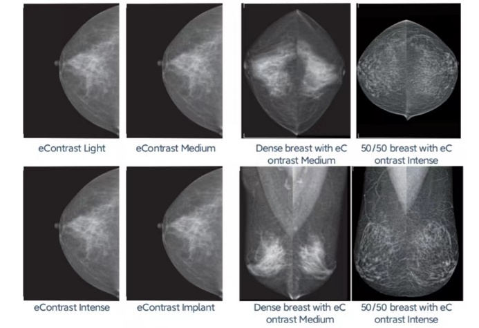 乳腺机是什么带你了解女性乳腺健康的“照妖镜”—乳腺机检查_https://www.jmylbn.com_新闻资讯_第7张