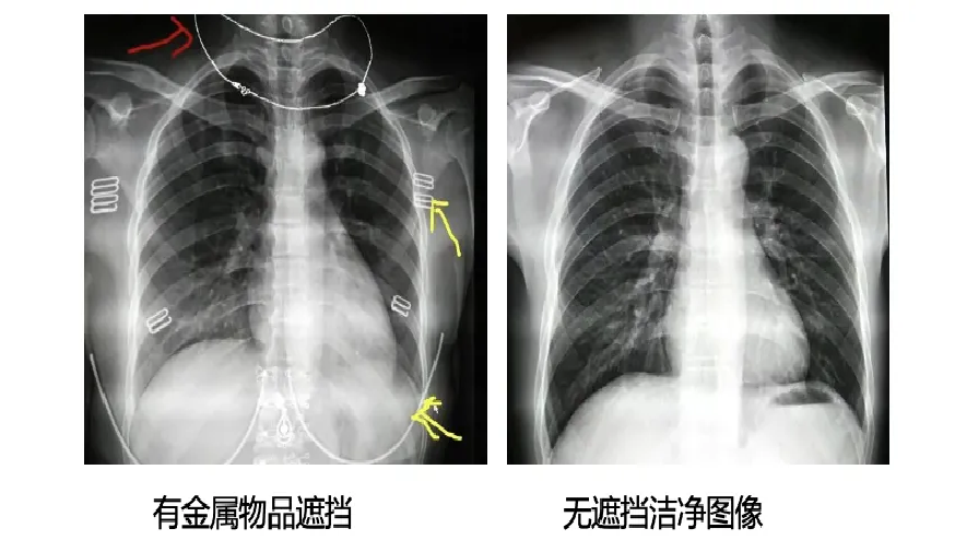 ct机器怎么分辨【健康科普】不一样机器看自己更清晰，DR和CT有什么区别？！_https://www.jmylbn.com_新闻资讯_第11张