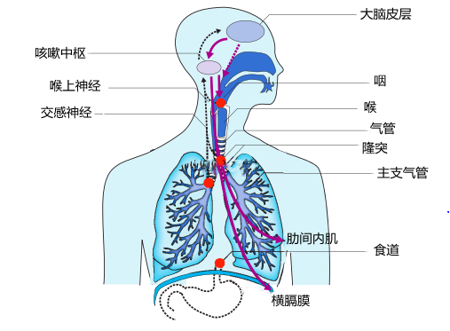 当人体的咽喉部,隆突等上气道遭受炎症,病原体感染等刺激后,位于气管