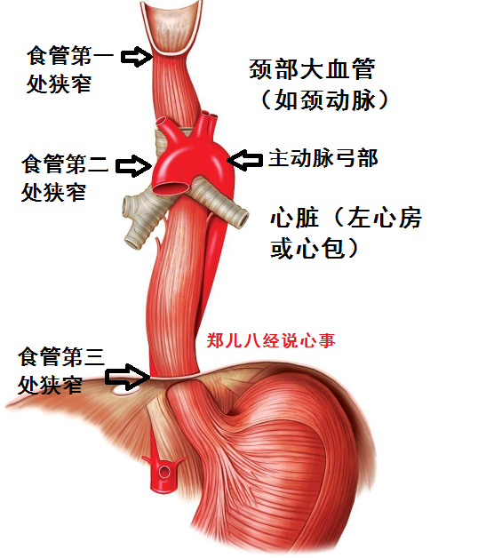图5 食管走形及其与附近组织器官解剖关系示意图食管鱼刺的"扎心之旅"