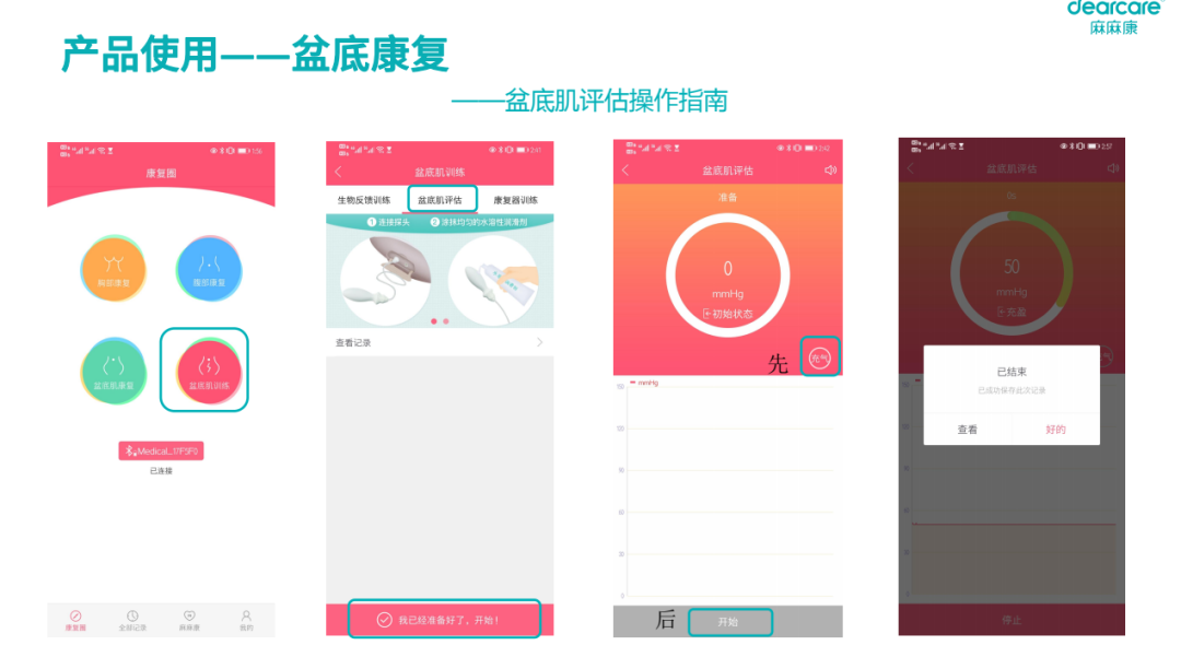 盆地康复仪器怎么用当年没做产后修复, 后悔6年, 找到医院产康仪器, 解决漏尿、腹直肌分离, 孩子妈来看看_https://www.jmylbn.com_新闻资讯_第44张