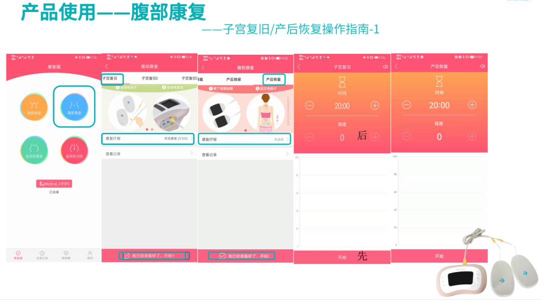 盆地康复仪器怎么用当年没做产后修复, 后悔6年, 找到医院产康仪器, 解决漏尿、腹直肌分离, 孩子妈来看看_https://www.jmylbn.com_新闻资讯_第54张