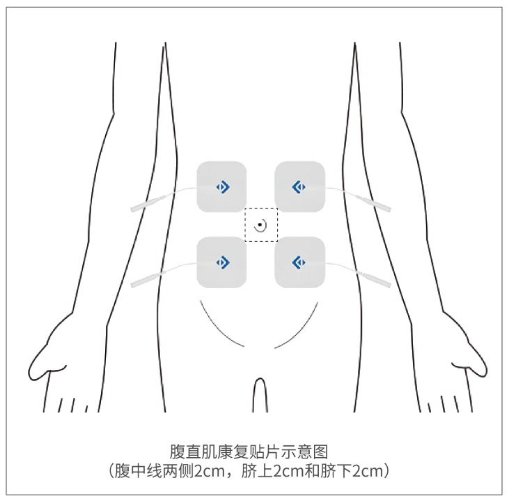 盆地康复仪器怎么用当年没做产后修复, 后悔6年, 找到医院产康仪器, 解决漏尿、腹直肌分离, 孩子妈来看看_https://www.jmylbn.com_新闻资讯_第51张