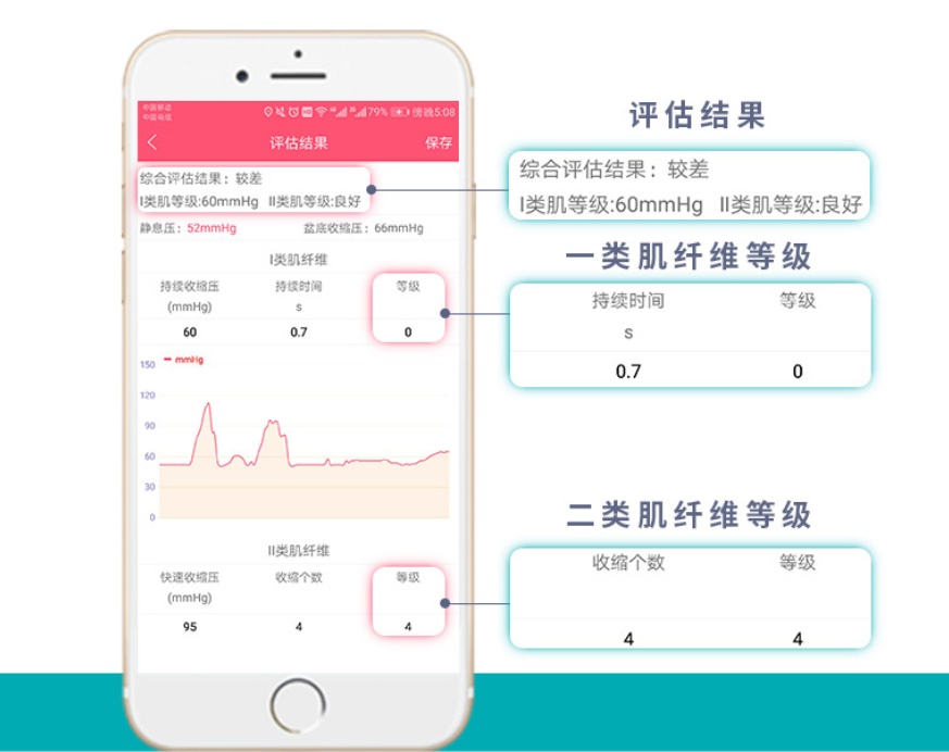 盆地康复仪器怎么用当年没做产后修复, 后悔6年, 找到医院产康仪器, 解决漏尿、腹直肌分离, 孩子妈来看看_https://www.jmylbn.com_新闻资讯_第45张