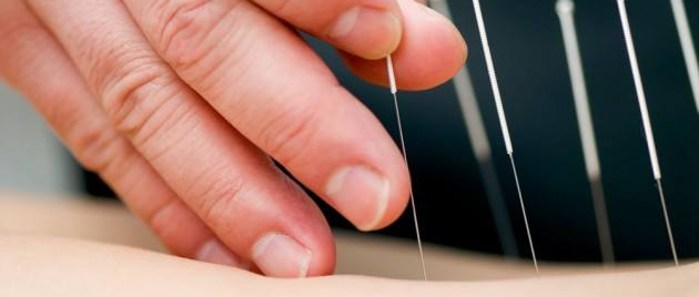 腰部针灸那些事儿，中医科护士你都清楚吗？