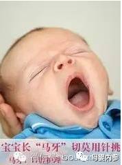 溃疡、鹅口疮、地图舌，宝宝7大口腔问题大解析！宝妈收藏！