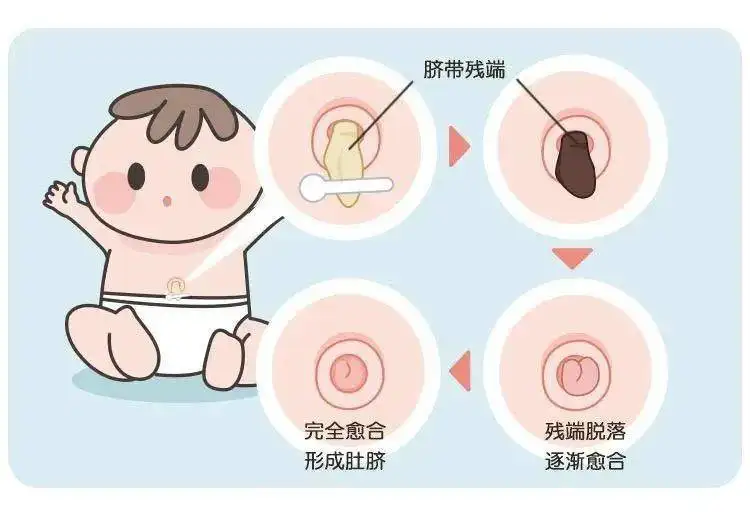 为什么剪脐带要先夹住新手爸妈训练营 ｜ 关于新生儿脐带护理，出生后一个月还不脱落正常吗？需要剪掉吗？_https://www.jmylbn.com_新闻资讯_第11张