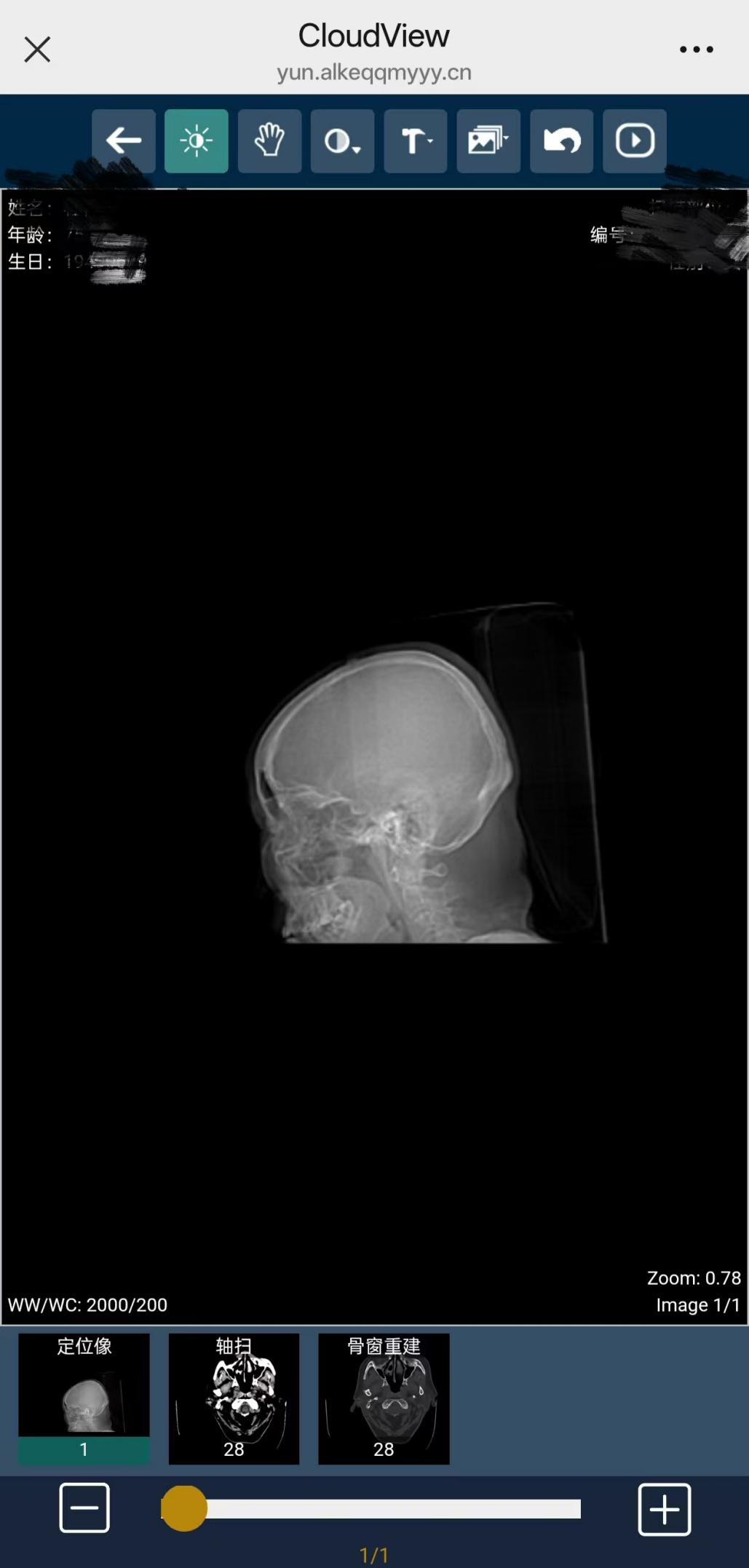 医用胶片怎么看我院“医学影像云胶片”服务正式上线啦！手机扫码就能查看_https://www.jmylbn.com_新闻资讯_第8张