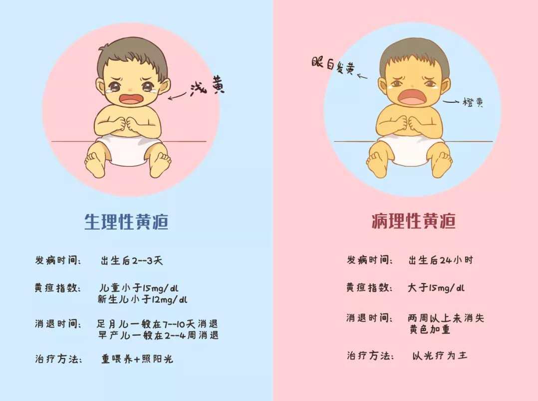 光疗时为什么黑眼罩【特色诊疗】随治随走，“黄疸宝宝”日间光疗来啦_https://www.jmylbn.com_新闻资讯_第8张
