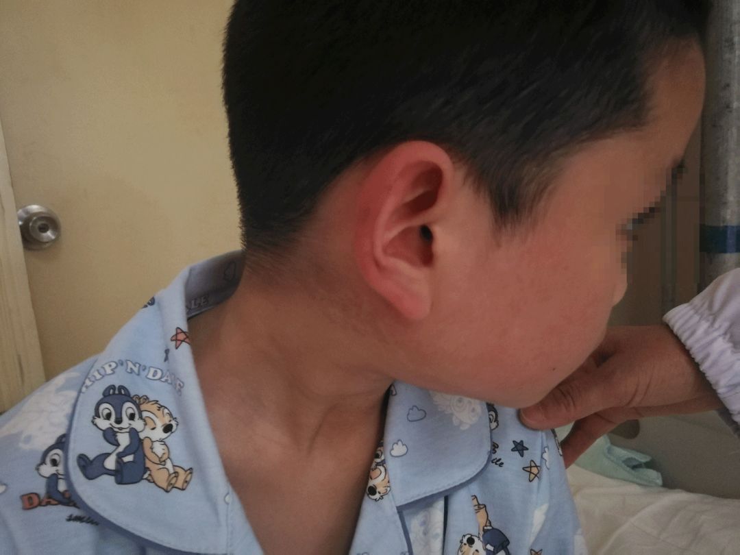 6月,广西已有235人死于传染病!这些病或威胁你的健康