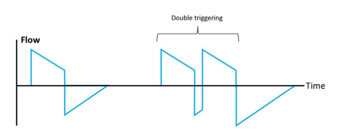 呼吸机模式怎么调节机械通气的基本模式_https://www.jmylbn.com_新闻资讯_第26张