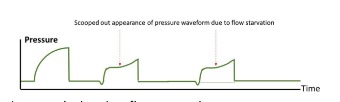 呼吸机模式怎么调节机械通气的基本模式_https://www.jmylbn.com_新闻资讯_第24张