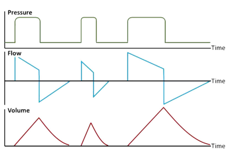 呼吸机模式怎么调节机械通气的基本模式_https://www.jmylbn.com_新闻资讯_第11张