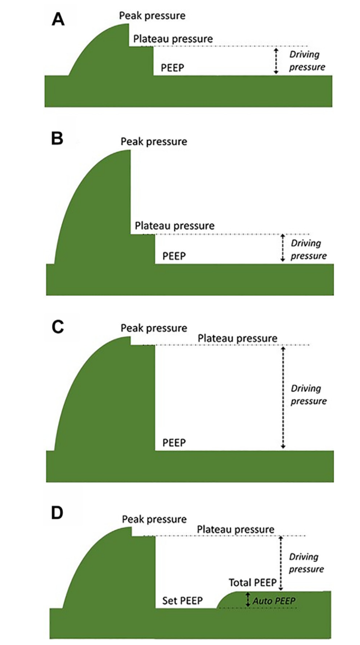 呼吸机模式怎么调节机械通气的基本模式_https://www.jmylbn.com_新闻资讯_第14张