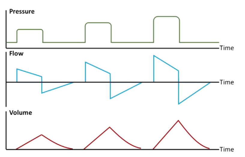 呼吸机模式怎么调节机械通气的基本模式_https://www.jmylbn.com_新闻资讯_第10张