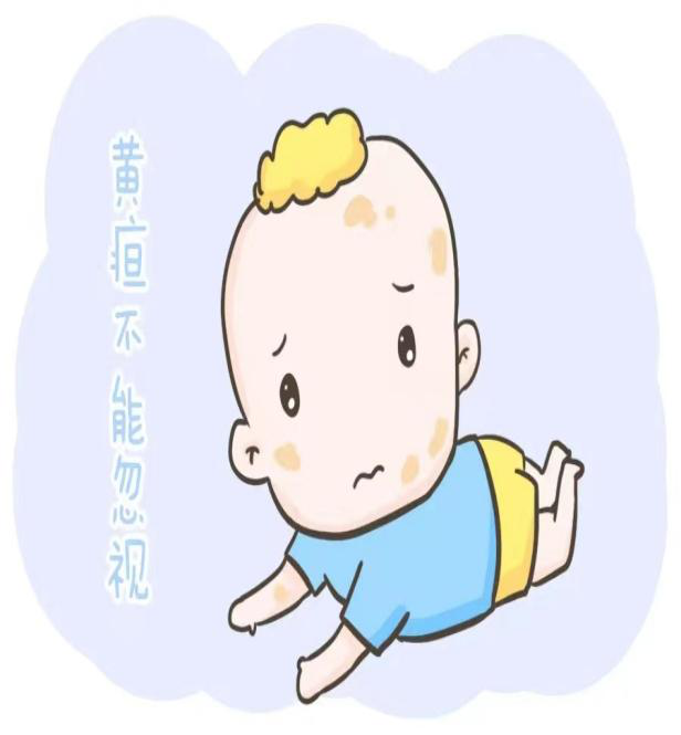 为什么要用光疗纸尿裤【原创科普】新生儿科黄疸日间光疗门诊科普_https://www.jmylbn.com_新闻资讯_第5张