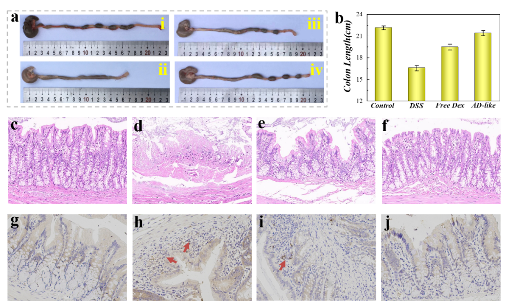 南京大学鼓楼医院赵远锦教授课题组：受爬山虎启发的药物微载体新进展的图5