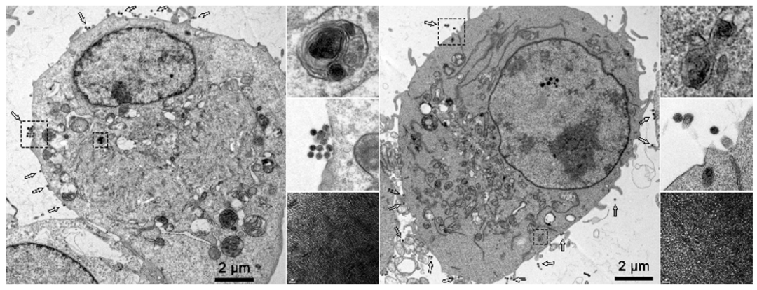 引流器排泄怎么用Research｜四川大学高会乐教授团队脑靶向纳米递药系统的脑排泄机制新进展_https://www.jmylbn.com_新闻资讯_第10张