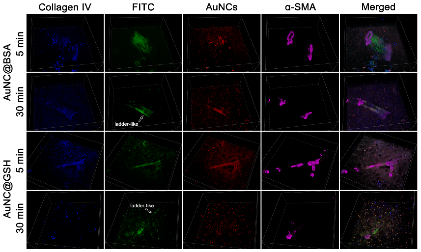 引流器排泄怎么用Research｜四川大学高会乐教授团队脑靶向纳米递药系统的脑排泄机制新进展_https://www.jmylbn.com_新闻资讯_第3张