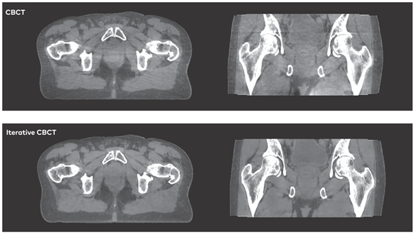 数字医用英文怎么拼写精准放疗的里程碑，新一代全智能数字化医用直线加速器Halcyon助推协和医疗航母乘风破浪_https://www.jmylbn.com_新闻资讯_第2张