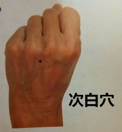 董氏奇穴治疗中风后遗症针方