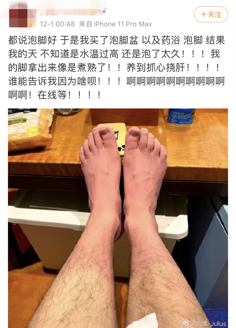 泡腳後差點要截肢？！不是人人都適合泡腳，這五類人一定要小心！ 健康 第4張