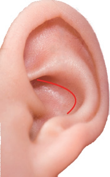 耳穴学习筑基篇——耳朵上的标志线-友友