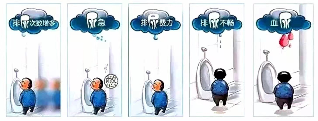 b膀胱镜为什么消毒泌尿外科迈向微创时代新“镜”界——膀胱镜_https://www.jmylbn.com_新闻资讯_第3张