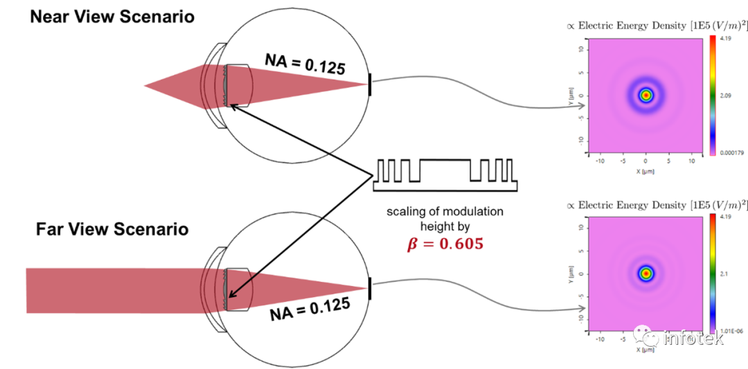 VirtualLab：醫(yī)用衍射透鏡