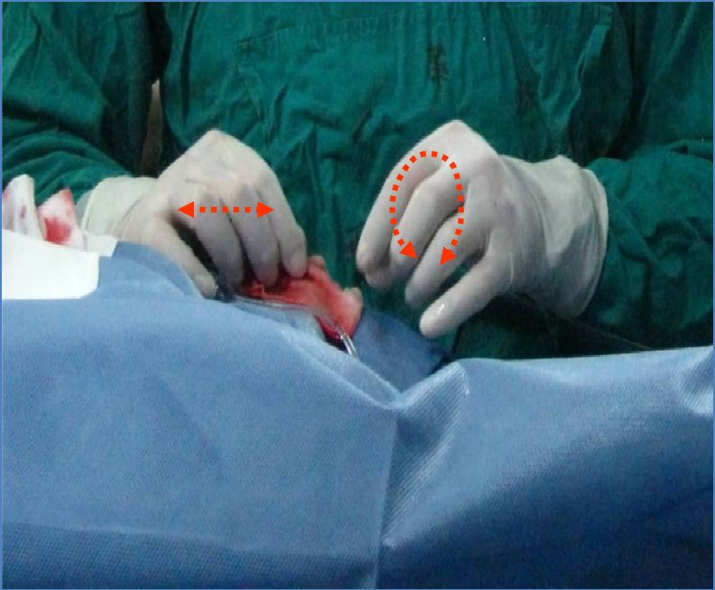 【超详细】介入导丝操作教程，心血管医生基础必备！