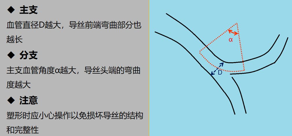 【超详细】介入导丝操作教程，心血管医生基础必备！