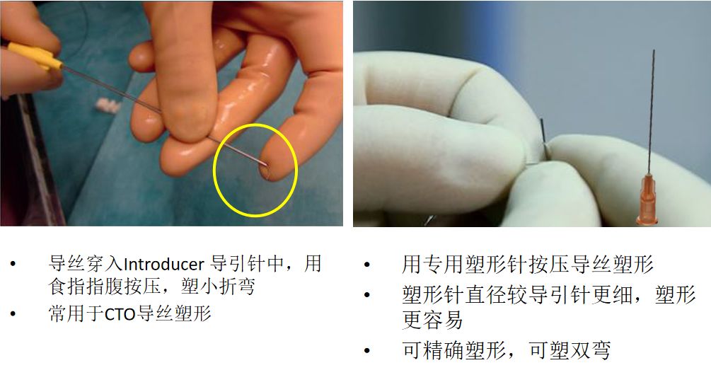 【超详细】介入导丝操作教程，心血管医生基础必备！