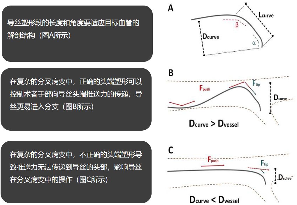 【超详细】介入导丝操作教程，心血管医生基础必备！