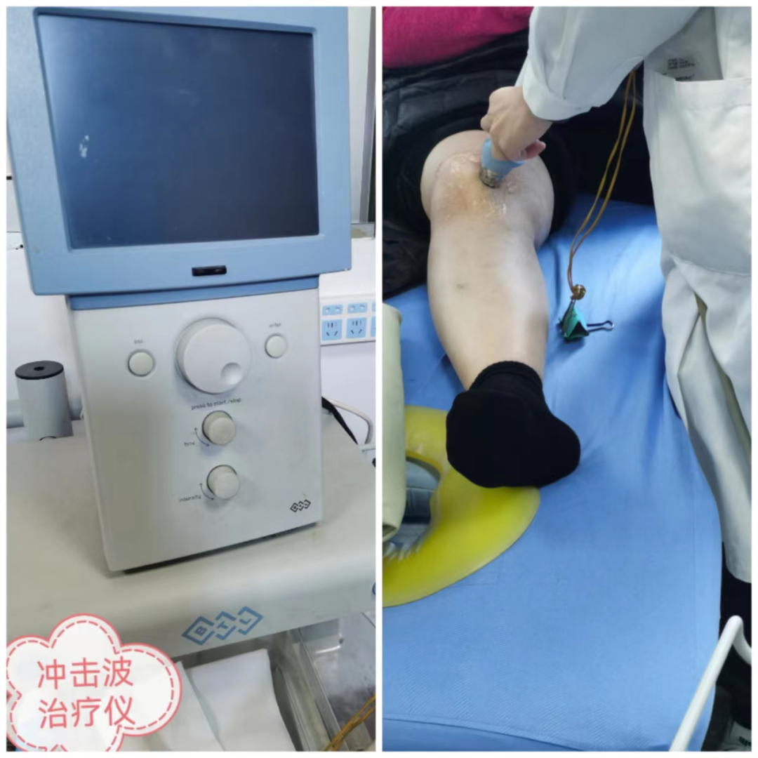 四肢联动怎么使用康复要去哪里做？连江县中医院康复医学科已正式投入使用……_https://www.jmylbn.com_新闻资讯_第22张