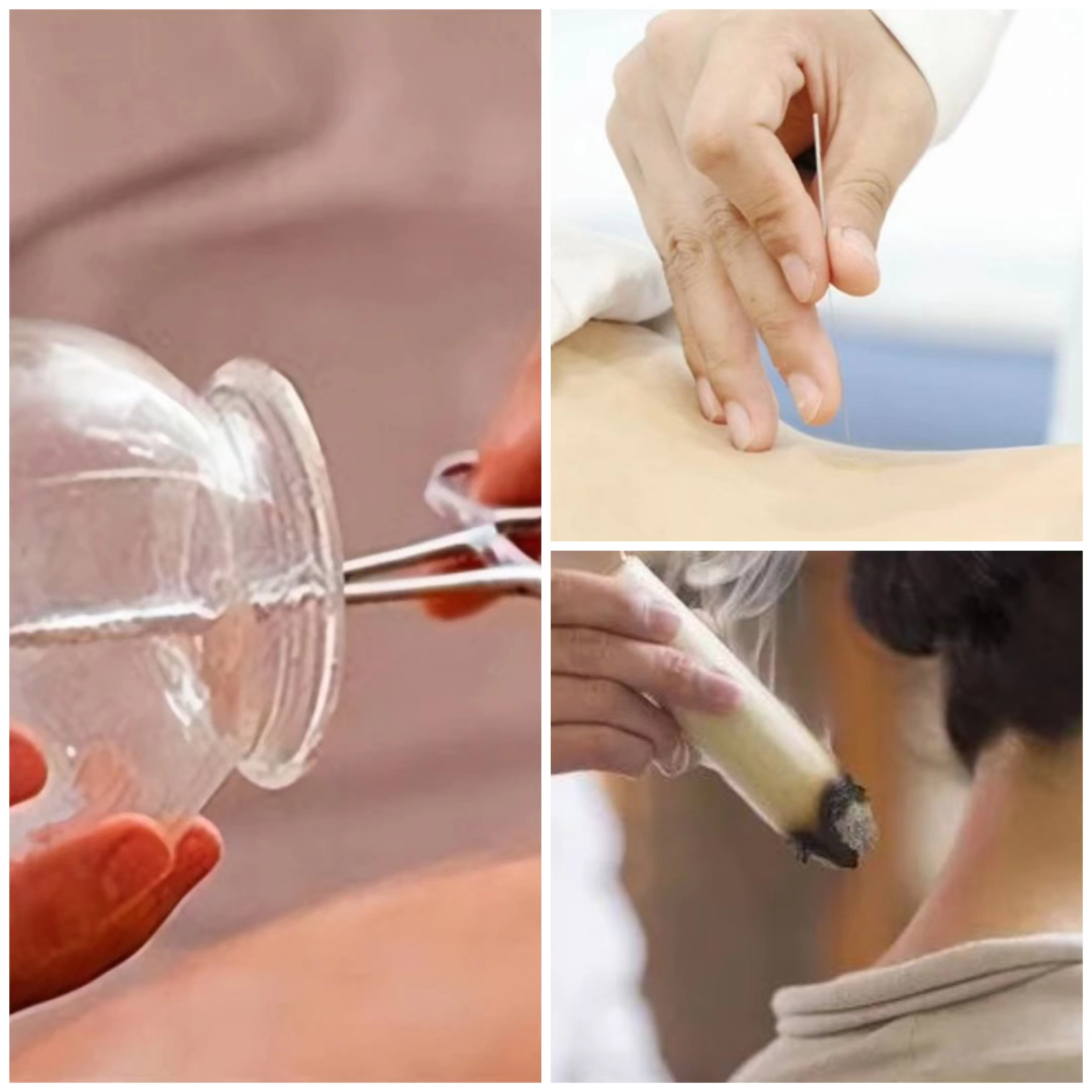 四肢联动怎么使用康复要去哪里做？连江县中医院康复医学科已正式投入使用……_https://www.jmylbn.com_新闻资讯_第19张