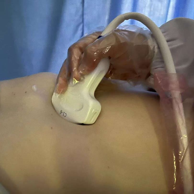 彩超logiq怎么读【重磅消息】更清晰！更高效！更多功能！我院引进GE LOGIQ-Fortis Plus彩超设备_https://www.jmylbn.com_新闻资讯_第10张