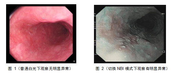 奥林巴斯胃肠镜怎么做精益求精，镜善镜美——我院引进“消化道保护神”奥林巴斯290电子胃肠镜系统_https://www.jmylbn.com_新闻资讯_第5张