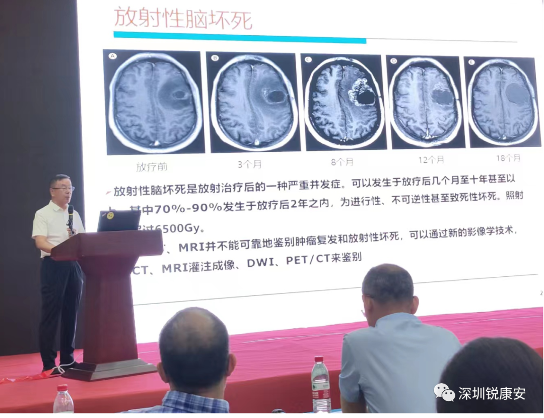 青岛市抗癌协会放射治疗专业委员会第21届年会圆满结束