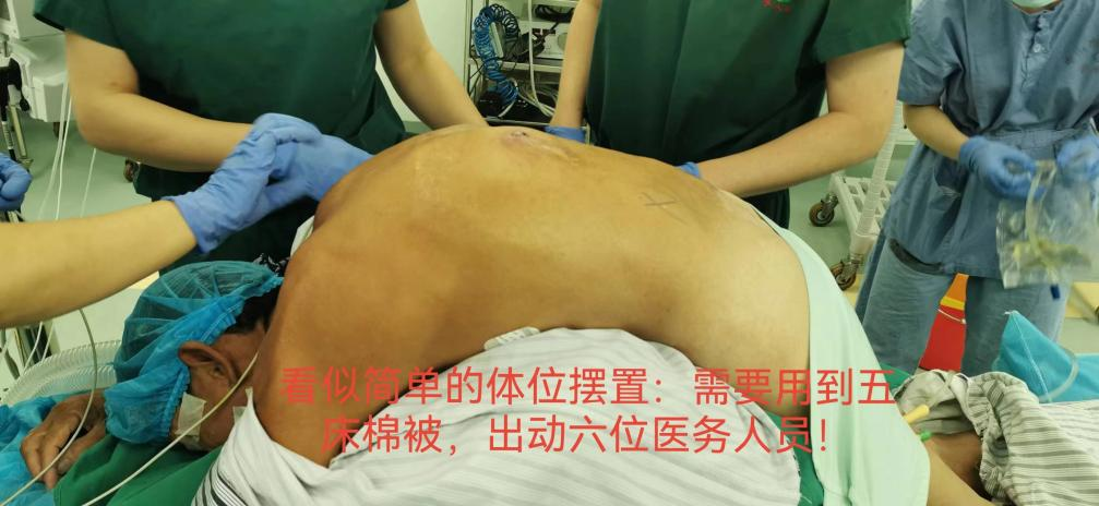 肋骨固定板怎么拆这样的脊柱内固定物，需要手术拆除_https://www.jmylbn.com_新闻资讯_第5张