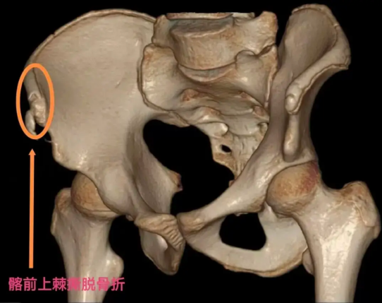 3D图片示意